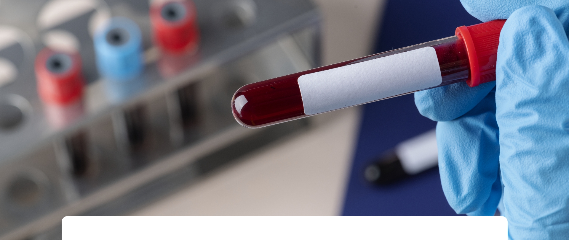 Hematología Hemostasia